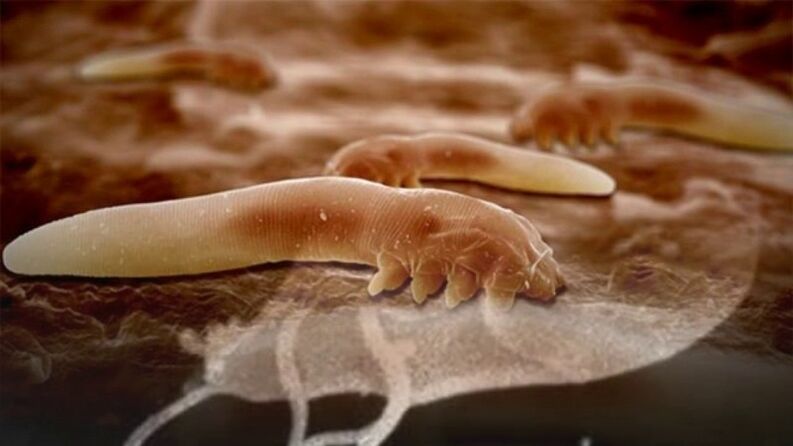 Parasite