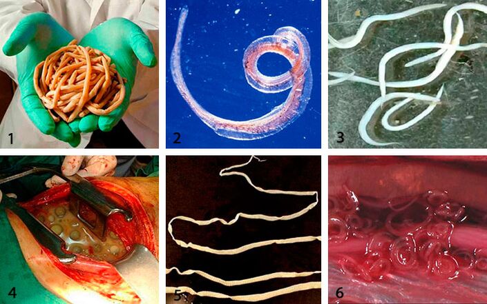 Parasite Types