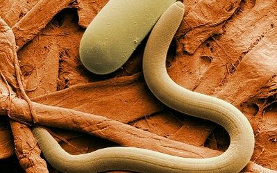 Causes of human worms