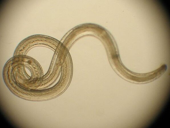 Trichinella spiralis is a human parasite