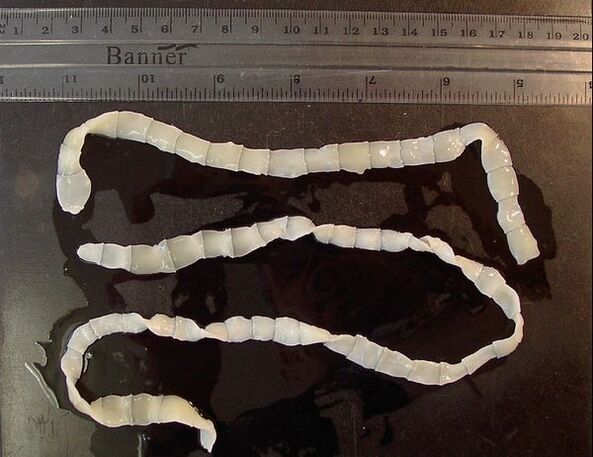 tapeworm from human body