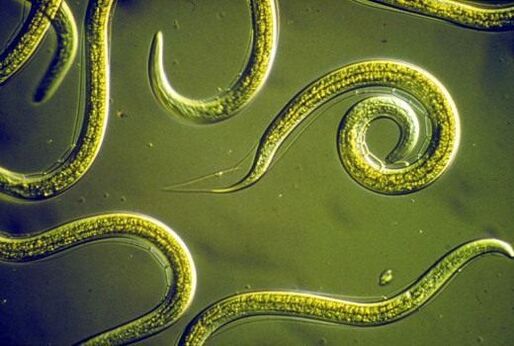 Parasitic nematode that lives in the human small intestine