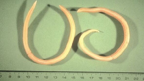 Roundworms are a type of worm that manifests itself in fatigue and coughing.