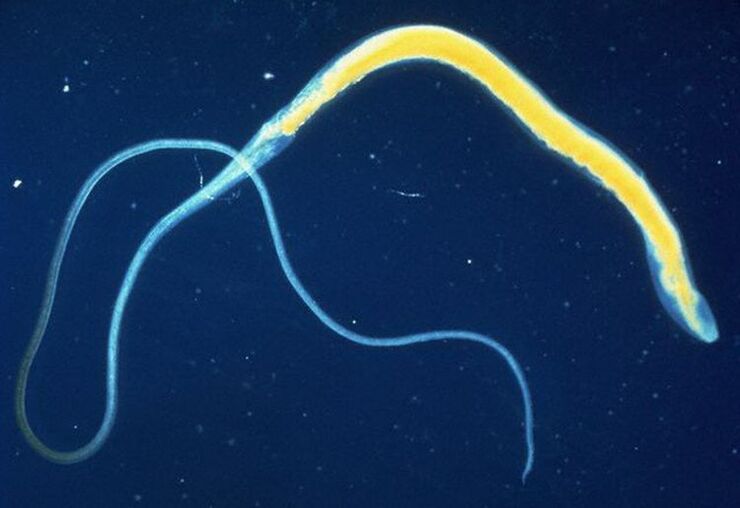 Whipworm is a common intestinal parasite.