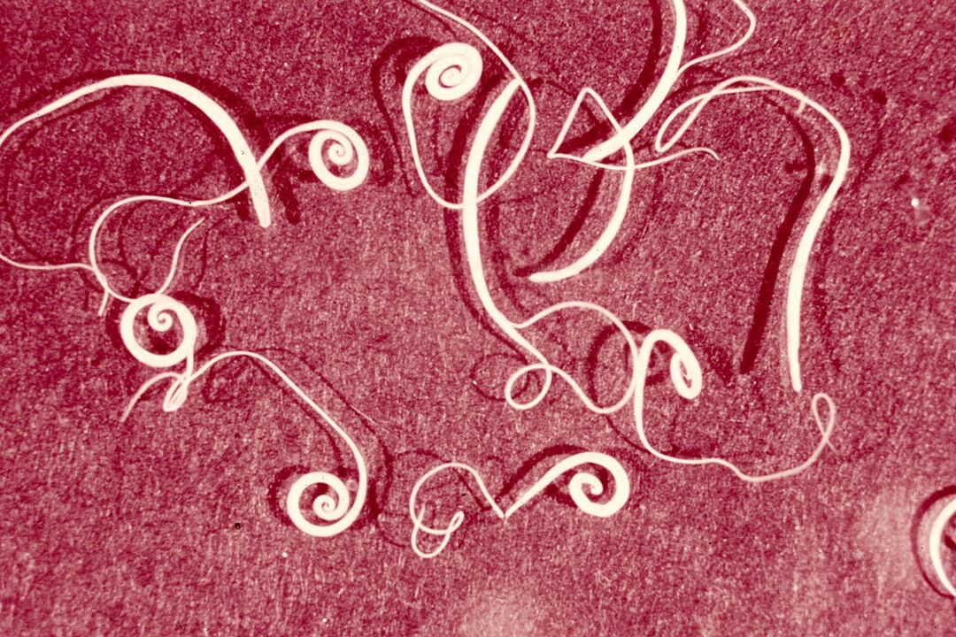 human Trichinella spiralis