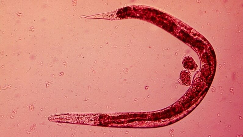 Human worm